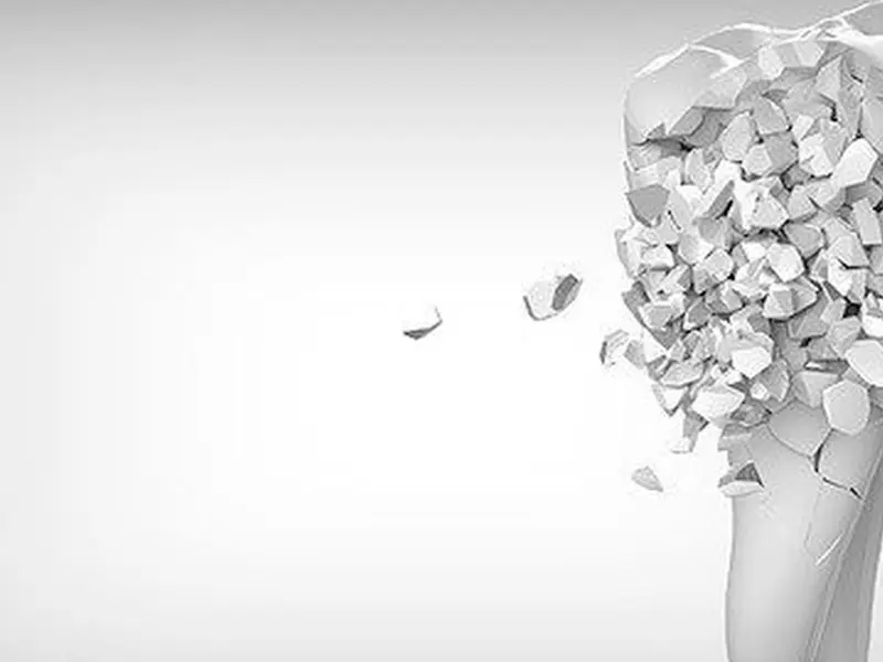 ¿Por qué son importantes las revisiones dentales periódicas? ¿Por qué son importantes las revisiones dentales periódicas?